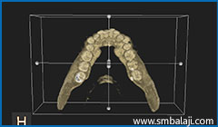 3D CBCT