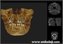 3D CBCT