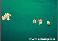 Removed impacted teeth