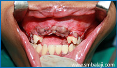 Upper jaw adequately advanced and brought into more favourable position in relation to lower jaw