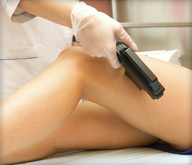 laser_hair_removal_ref_guide